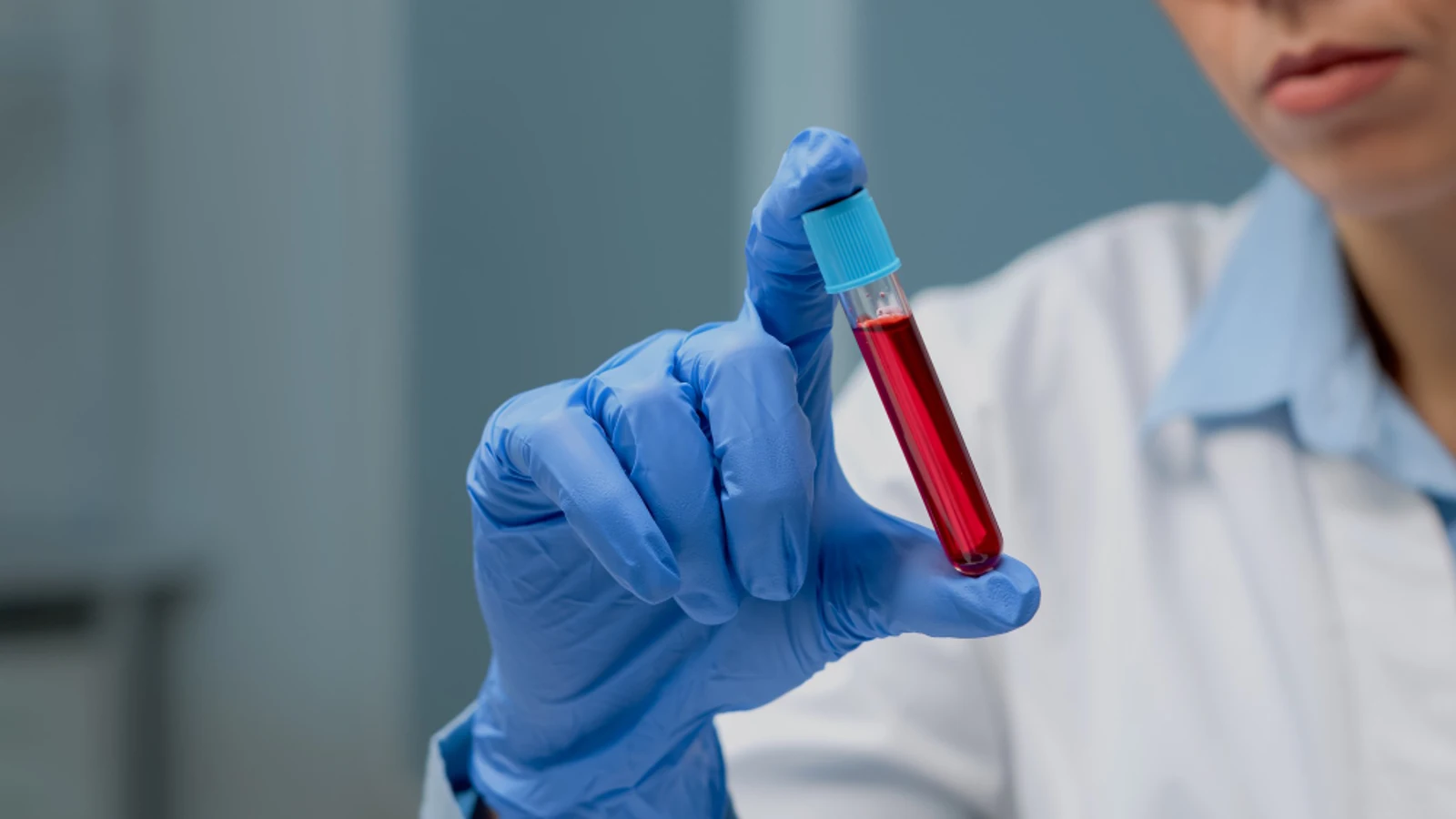 Nuevo test de sangre detecta 18 tipos de cáncer antes de que aparezcan los síntomas