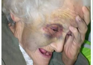 Cobarde: Sometió a golpes a su propia madre de 85 años y luego se fugó