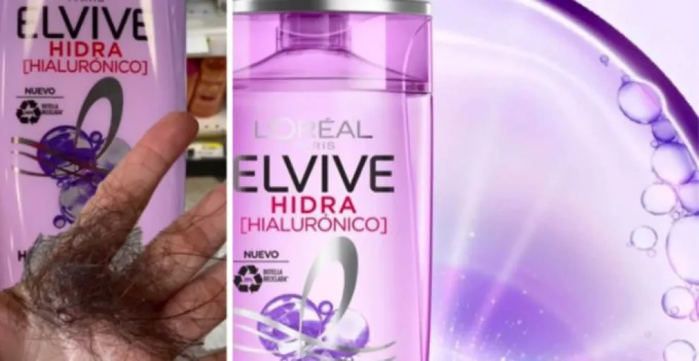 Chile abrirá investigación a L’Oréal por múltiples denuncias contra un champú de la marca que está dejando calva a la gente