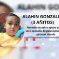 Ayudemos al niño Alahin González para que se le realice una cirugía reconstructiva de paladar