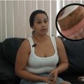 Denuncian presunta mala praxis en clínica estética de Barquisimeto: “Me decía que para ser bella había que ver estrellas”