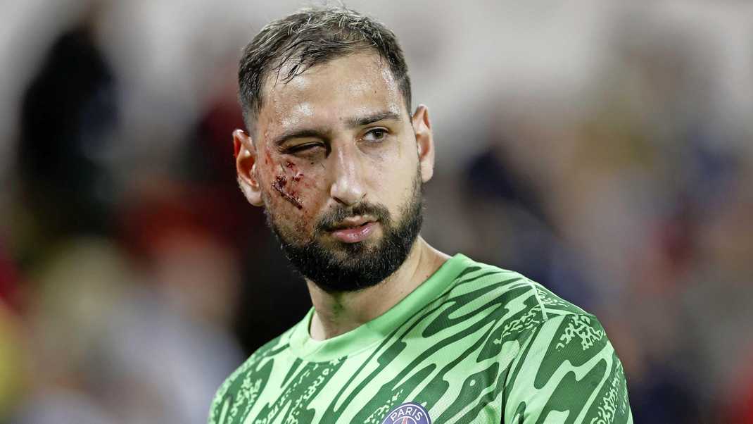 Donnarumma recibió una impactante patada en el rostro durante el duelo del PSG ante Mónaco